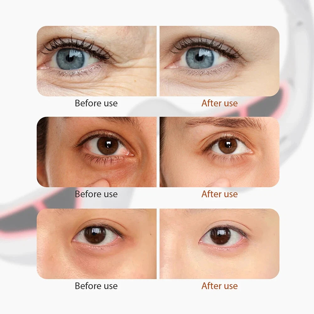 HDRGK® eye massager w/ red light infrared